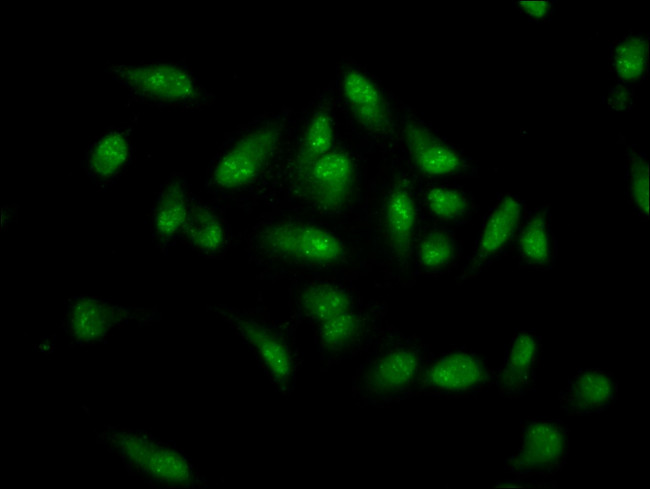 MKX Antibody in Immunocytochemistry (ICC/IF)