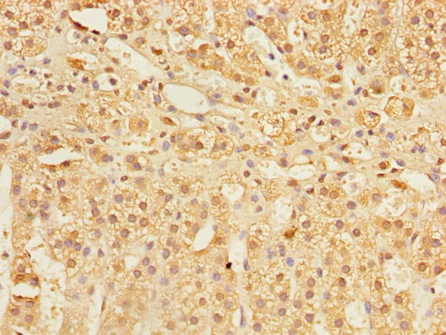 COMMD1 Antibody in Immunohistochemistry (Paraffin) (IHC (P))