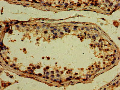TTLL6 Antibody in Immunohistochemistry (Paraffin) (IHC (P))