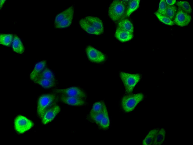 ATP6V0D2 Antibody in Immunocytochemistry (ICC/IF)