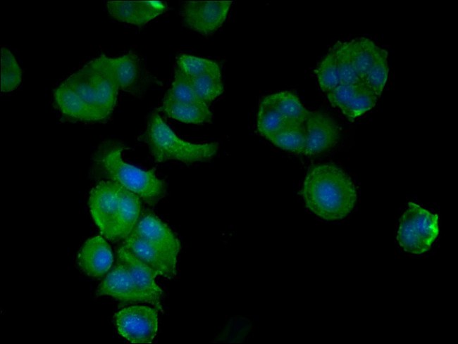 CCDC112 Antibody in Immunocytochemistry (ICC/IF)