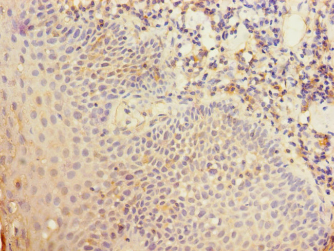 CD35 Antibody in Immunohistochemistry (Paraffin) (IHC (P))