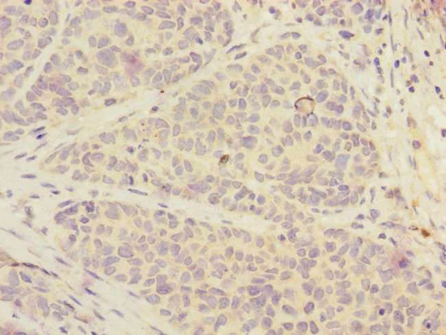 FOXRED1 Antibody in Immunohistochemistry (Paraffin) (IHC (P))