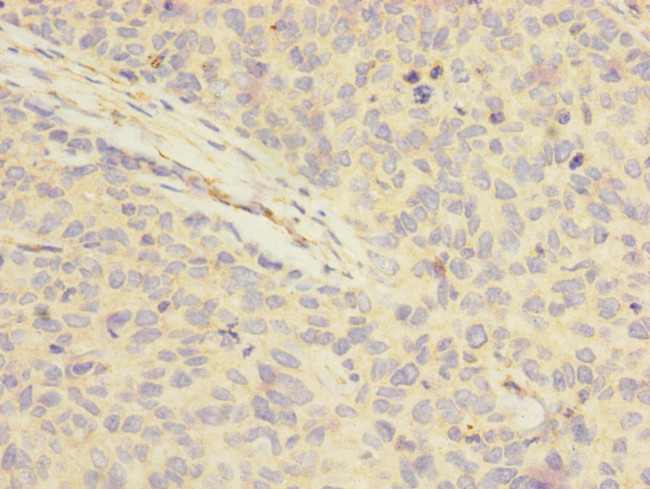 FOXRED1 Antibody in Immunohistochemistry (Paraffin) (IHC (P))