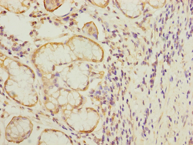 MTERFD1 Antibody in Immunohistochemistry (Paraffin) (IHC (P))