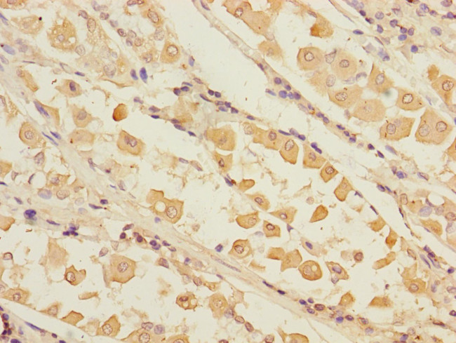 Pirh2 Antibody in Immunohistochemistry (Paraffin) (IHC (P))