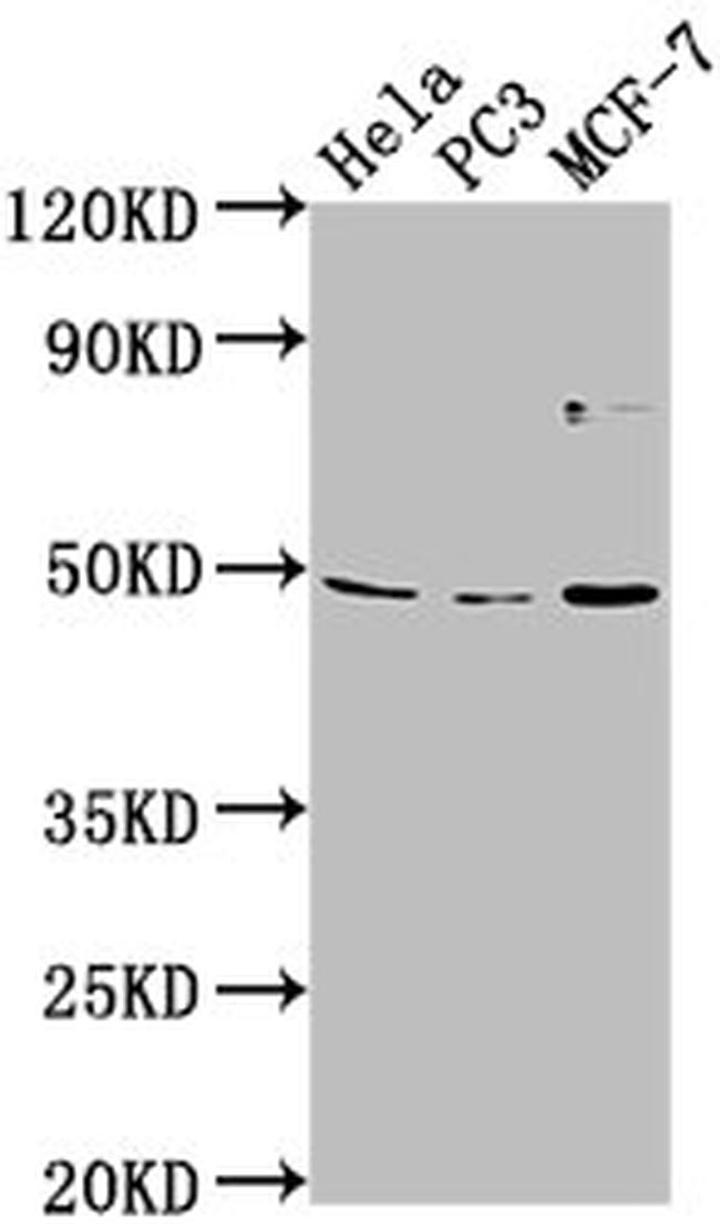 TMEM237 Antibody in Western Blot (WB)
