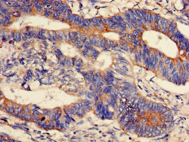 PPM1K Antibody in Immunohistochemistry (Paraffin) (IHC (P))