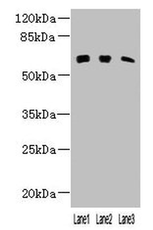 KLHL23 Antibody in Western Blot (WB)