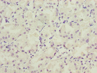 LRRC20 Antibody in Immunohistochemistry (Paraffin) (IHC (P))