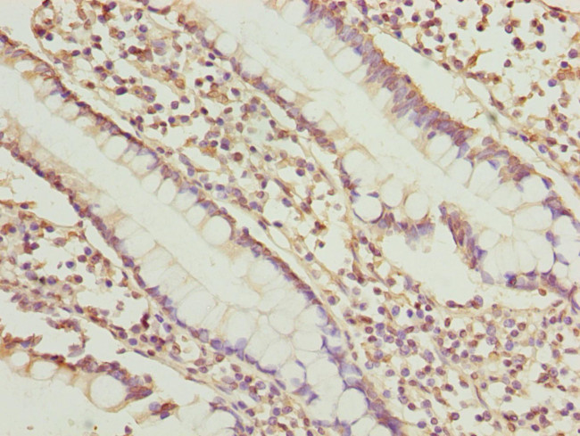 SGCD Antibody in Immunohistochemistry (Paraffin) (IHC (P))