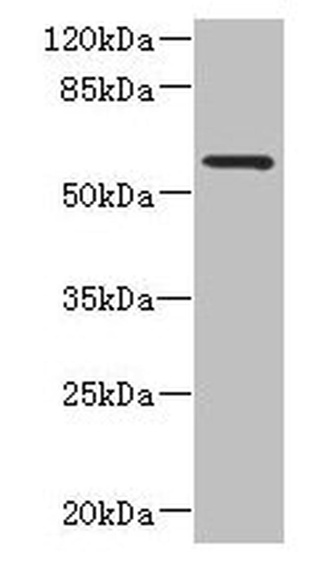 FCRL4 Antibody in Western Blot (WB)