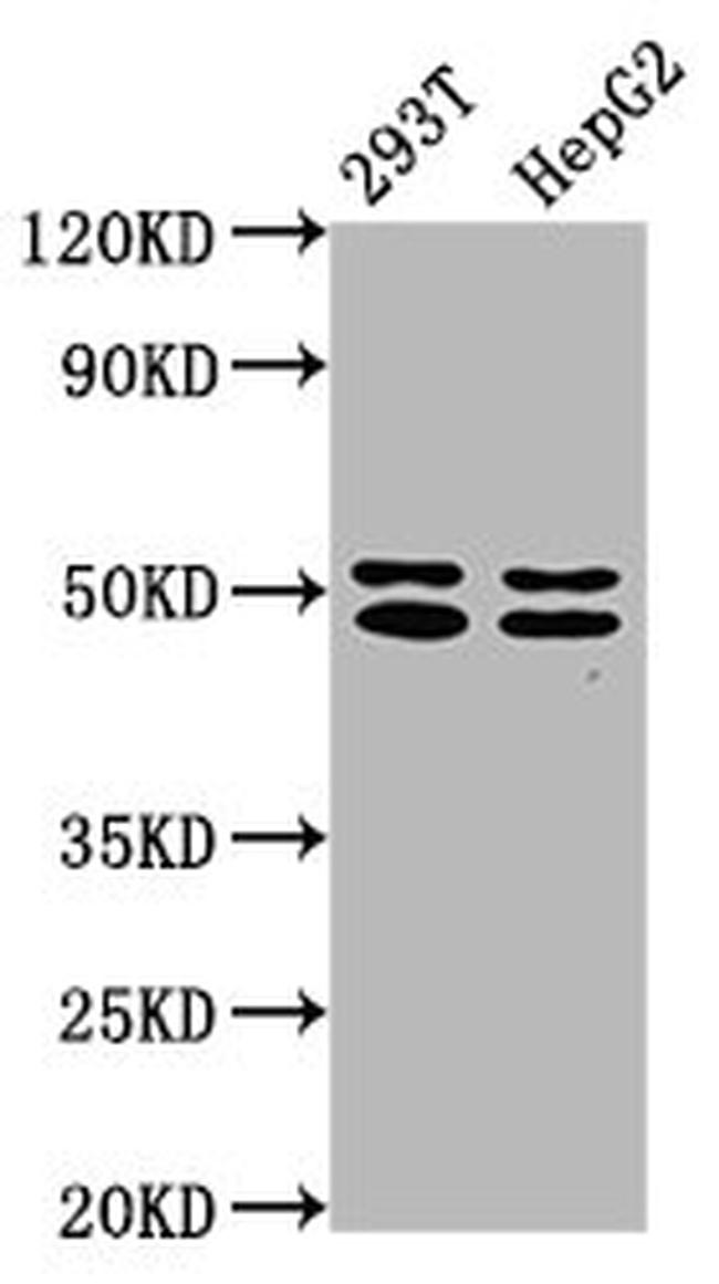 TRNT1 Antibody in Western Blot (WB)