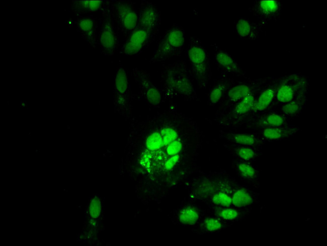 RNaseH2C Antibody in Immunocytochemistry (ICC/IF)