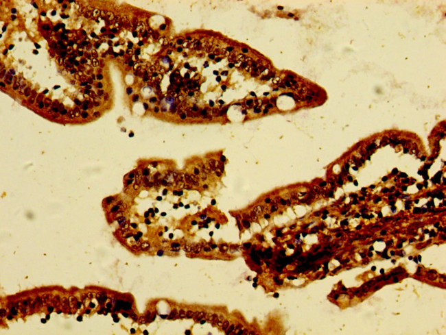 ANR49 Antibody in Immunohistochemistry (Paraffin) (IHC (P))