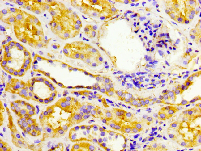 EPSTI1 Antibody in Immunohistochemistry (Paraffin) (IHC (P))