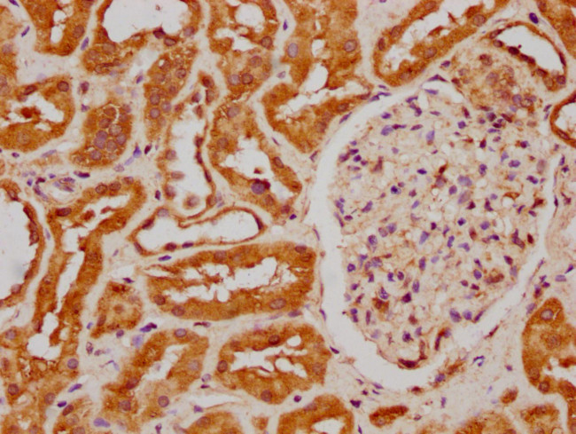 FIZ1 Antibody in Immunohistochemistry (Paraffin) (IHC (P))
