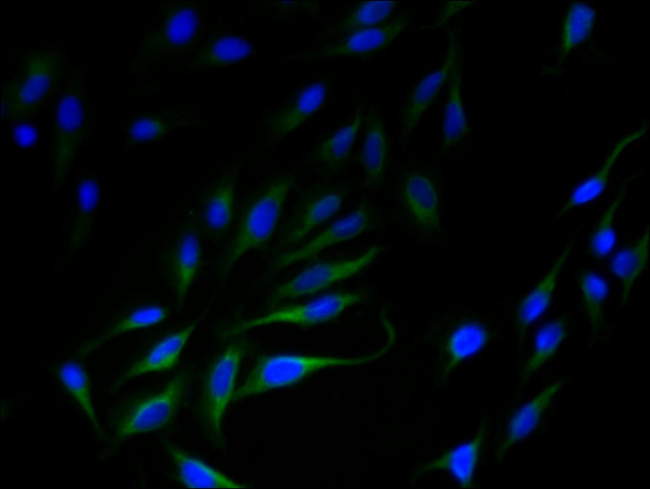 SLC35F5 Antibody in Immunocytochemistry (ICC/IF)