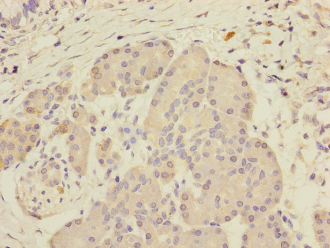 SCFD1 Antibody in Immunohistochemistry (Paraffin) (IHC (P))