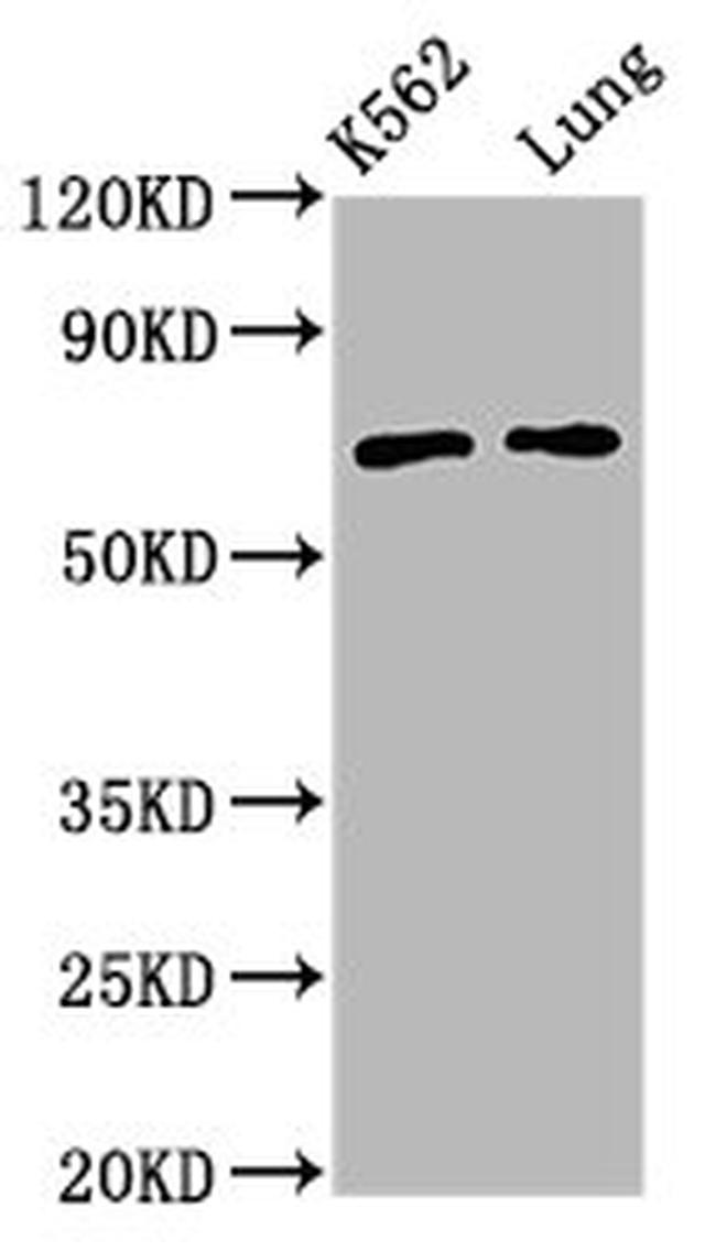 POF1B Antibody in Western Blot (WB)