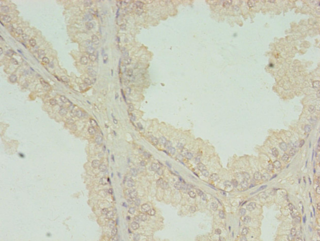 RQCD1 Antibody in Immunohistochemistry (Paraffin) (IHC (P))
