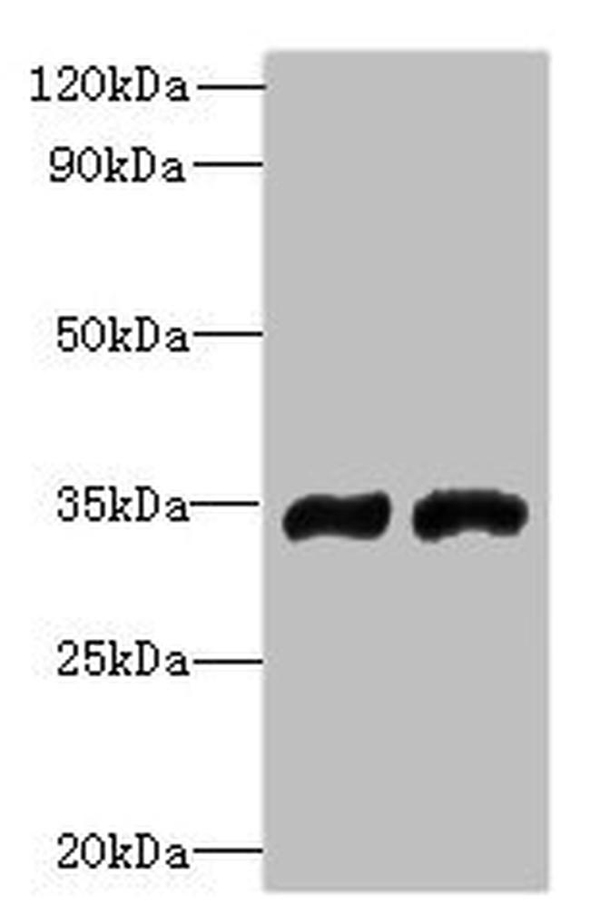 FYTTD1 Antibody in Western Blot (WB)