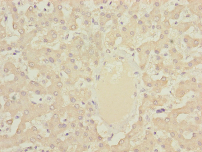 DYNC2LI1 Antibody in Immunohistochemistry (Paraffin) (IHC (P))