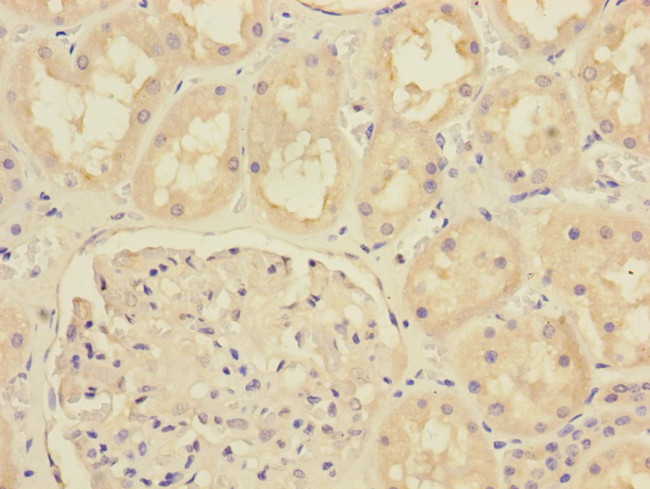 MTO1 Antibody in Immunohistochemistry (Paraffin) (IHC (P))