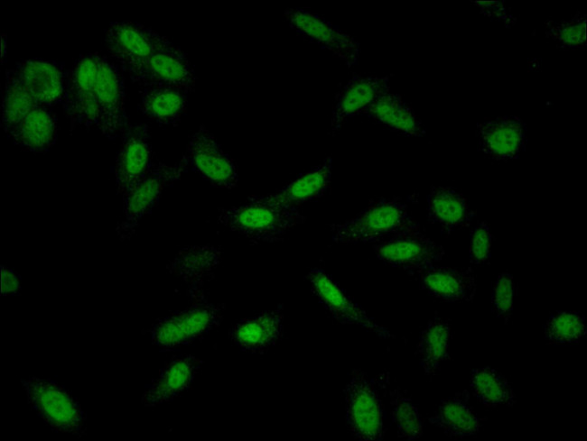 SMARCD1 Antibody in Immunocytochemistry (ICC/IF)