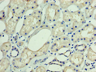 DNAJC30 Antibody in Immunohistochemistry (Paraffin) (IHC (P))