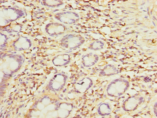 OTUD6B Antibody in Immunohistochemistry (Paraffin) (IHC (P))