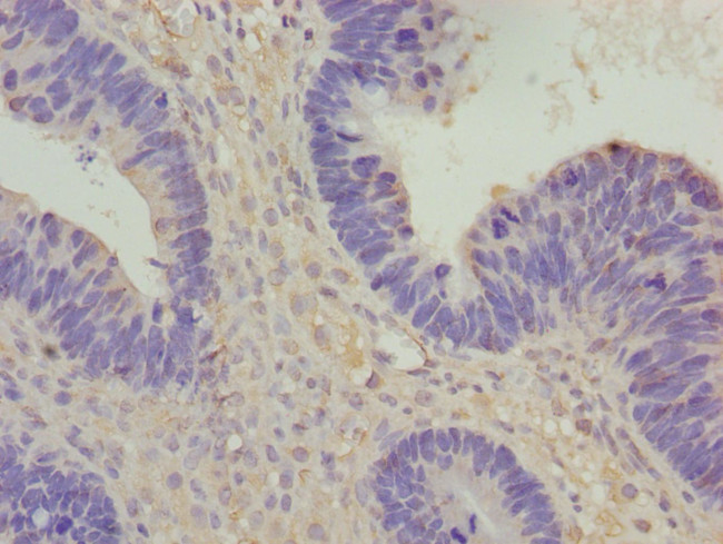 VANGL1 Antibody in Immunohistochemistry (Paraffin) (IHC (P))