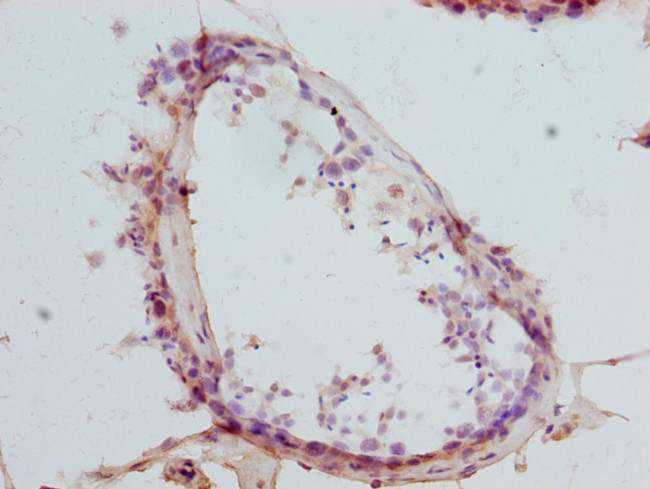 CTNNBL1 Antibody in Immunohistochemistry (Paraffin) (IHC (P))