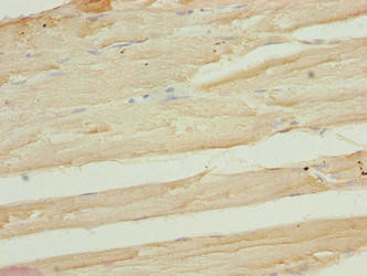 FAM82B Antibody in Immunohistochemistry (Paraffin) (IHC (P))