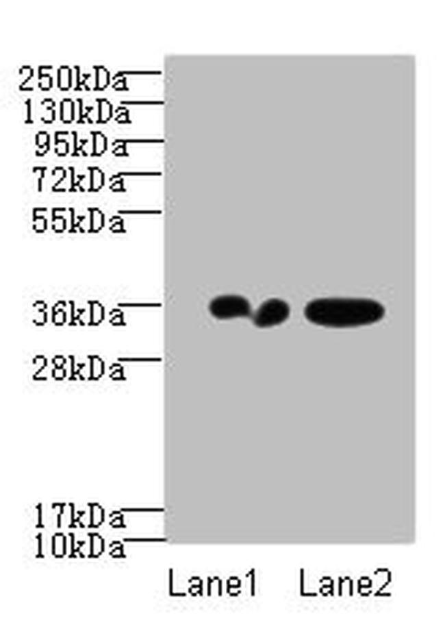 RPRD1A Antibody in Western Blot (WB)