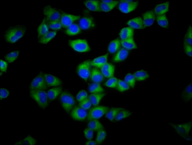 GSDMA Antibody in Immunocytochemistry (ICC/IF)