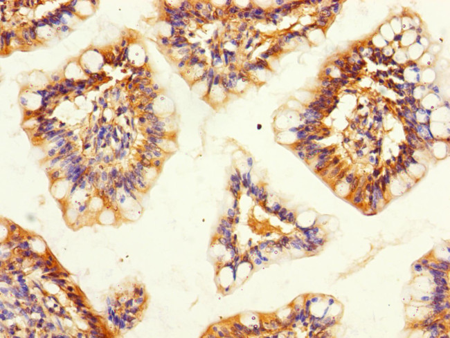 SNX18 Antibody in Immunohistochemistry (Paraffin) (IHC (P))
