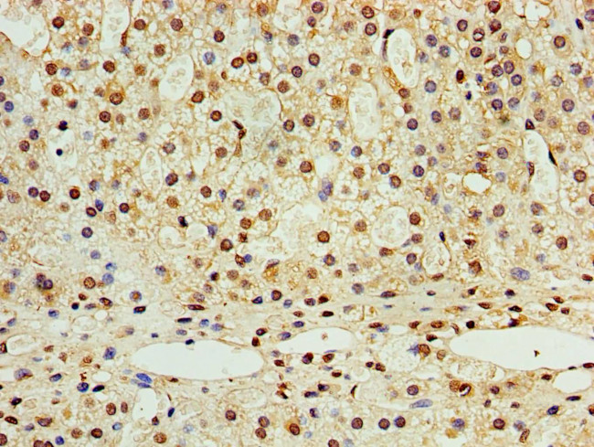 STK32A Antibody in Immunohistochemistry (Paraffin) (IHC (P))