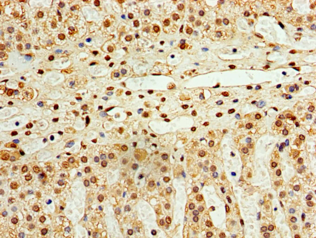 STK32A Antibody in Immunohistochemistry (Paraffin) (IHC (P))