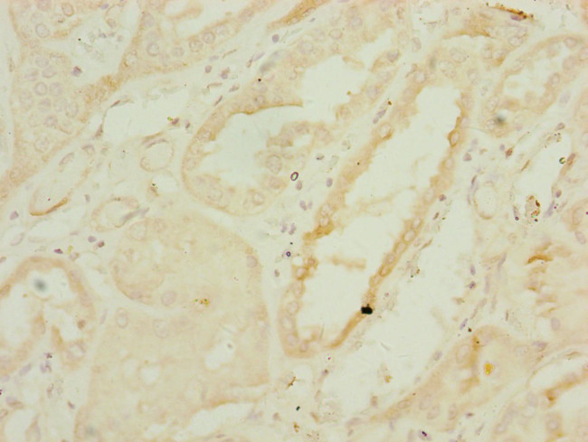 DNAJC19 Antibody in Immunohistochemistry (Paraffin) (IHC (P))