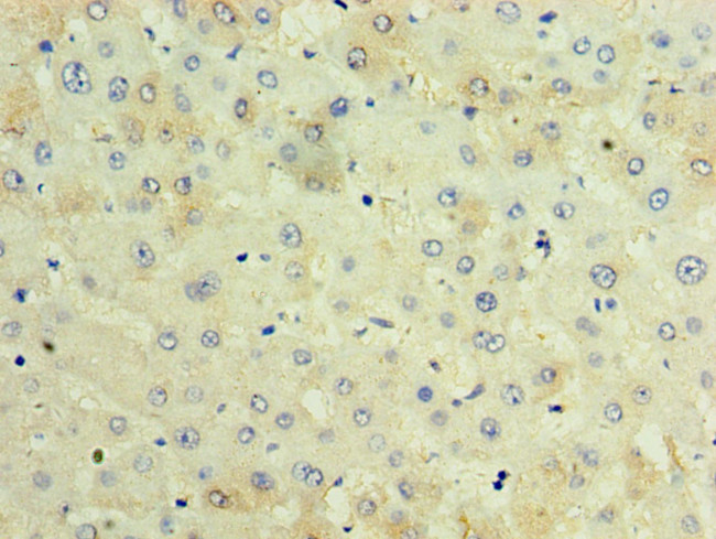 TCTN2 Antibody in Immunohistochemistry (Paraffin) (IHC (P))