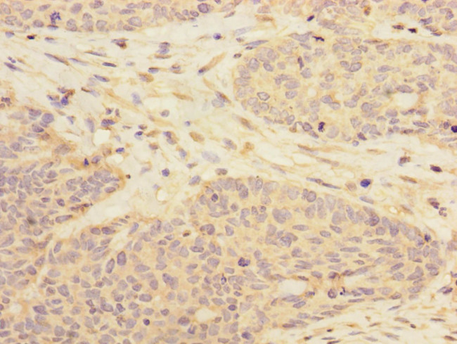 RBM17 Antibody in Immunohistochemistry (Paraffin) (IHC (P))