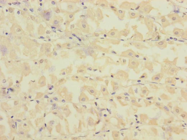 FCRL2 Antibody in Immunohistochemistry (Paraffin) (IHC (P))