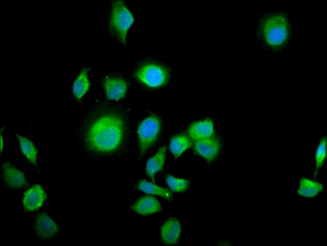 ALS2CR12 Antibody in Immunocytochemistry (ICC/IF)