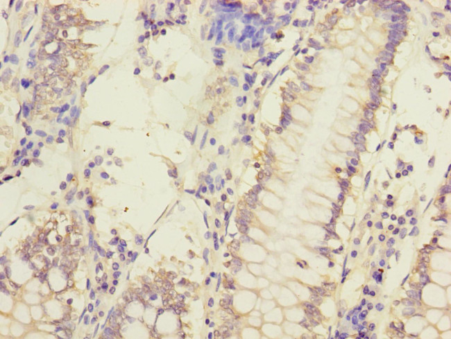 MCCC1 Antibody in Immunohistochemistry (Paraffin) (IHC (P))