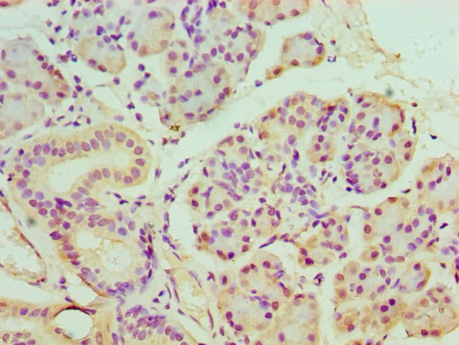 BANP Antibody in Immunohistochemistry (Paraffin) (IHC (P))
