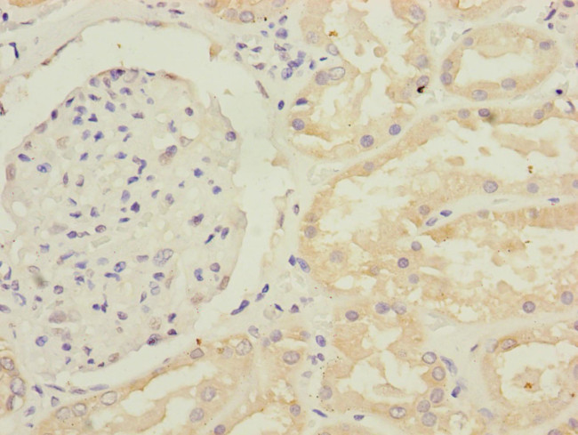 GFM2 Antibody in Immunohistochemistry (Paraffin) (IHC (P))