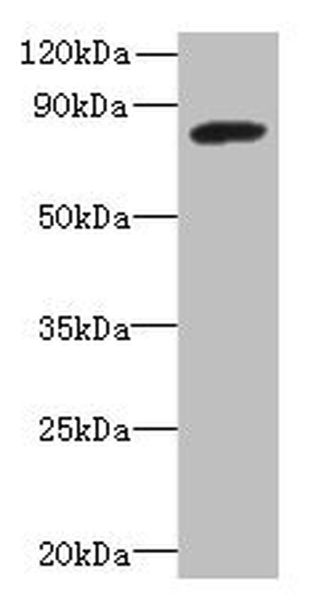 PBXIP1 Antibody in Western Blot (WB)