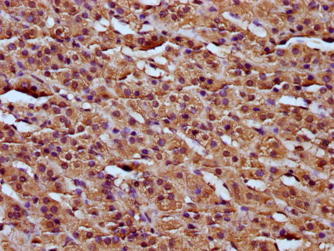 RCN3 Antibody in Immunohistochemistry (Paraffin) (IHC (P))