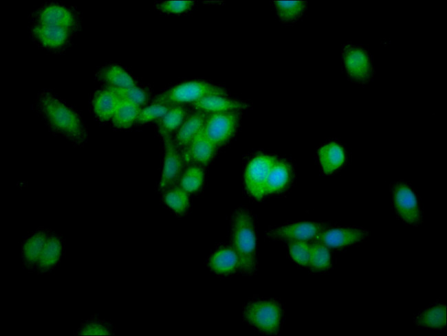 ERGIC2 Antibody in Immunocytochemistry (ICC/IF)